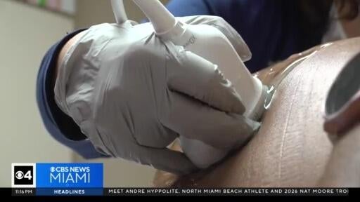 Birth rate for women over the age of 35, or mature pregnancies, is rising — CBS Miami, Parkland Health news