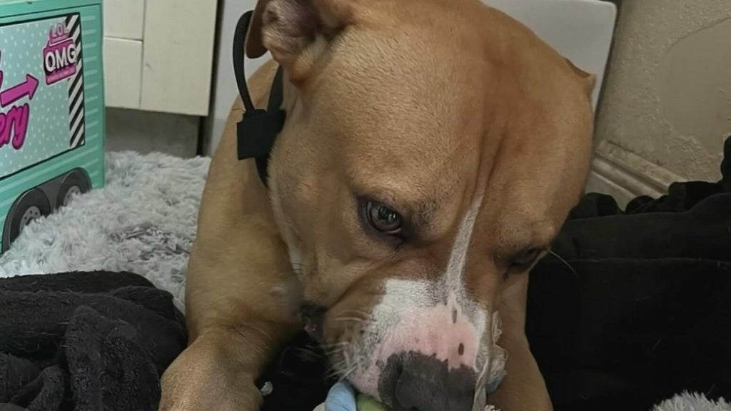 Teen girl remains hospitalized after dog attack in northwest Miami-Dade; owner surrenders pit bull — CBS Miami, Parkland Health news